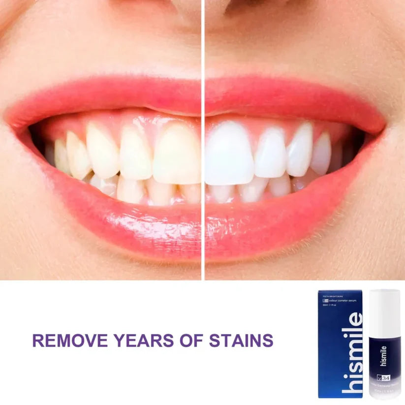 V34 Hi-Smile Teeth Whitener